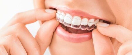 Can Invisalign Fix a Snaggletooth
